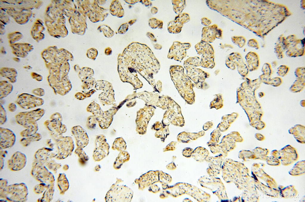 Immunohistochemistry (IHC) staining of human placenta tissue using EMILIN1 Polyclonal antibody (10643-1-AP)