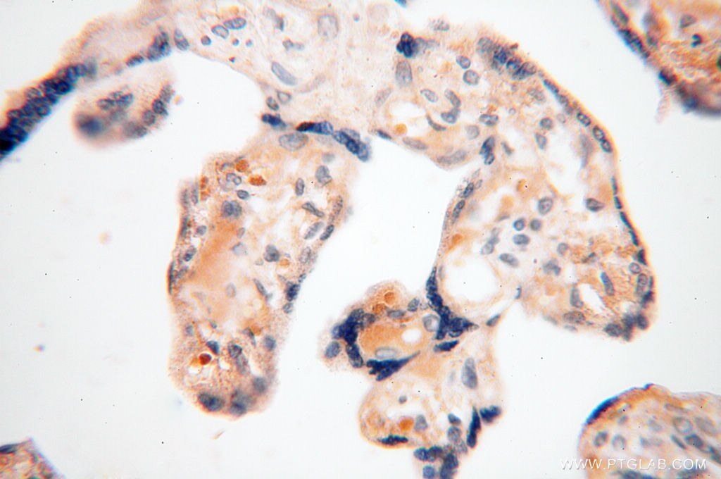 Immunohistochemistry (IHC) staining of human placenta tissue using EMILIN1 Polyclonal antibody (10643-1-AP)