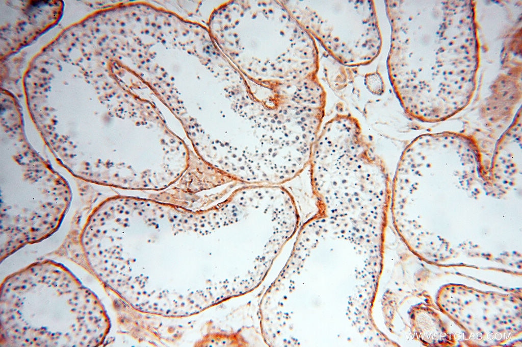 Immunohistochemistry (IHC) staining of human testis tissue using EMILIN1 Polyclonal antibody (10643-1-AP)