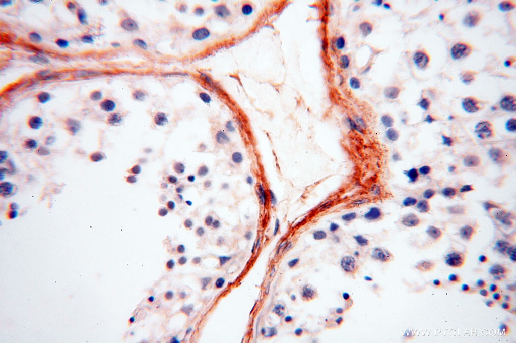 Immunohistochemistry (IHC) staining of human testis tissue using EMILIN1 Polyclonal antibody (10643-1-AP)