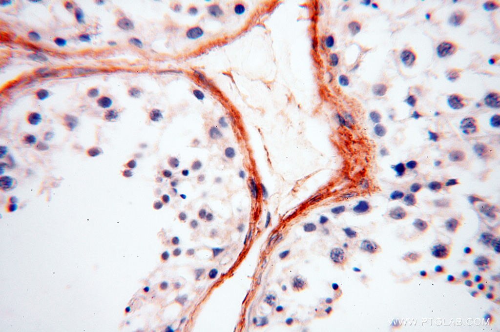 IHC staining of human testis using 10643-1-AP