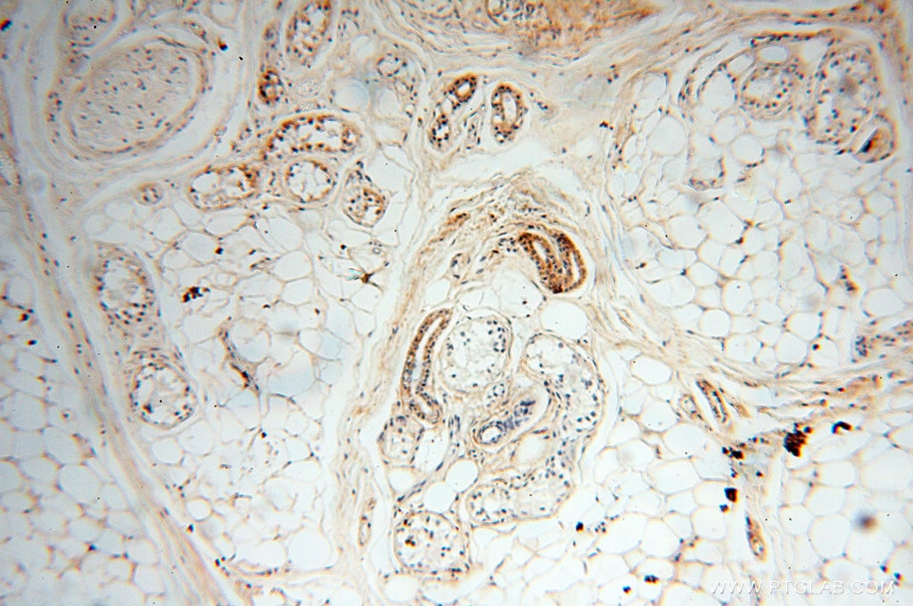 Immunohistochemistry (IHC) staining of human skin tissue using EMILIN1 Polyclonal antibody (10643-1-AP)