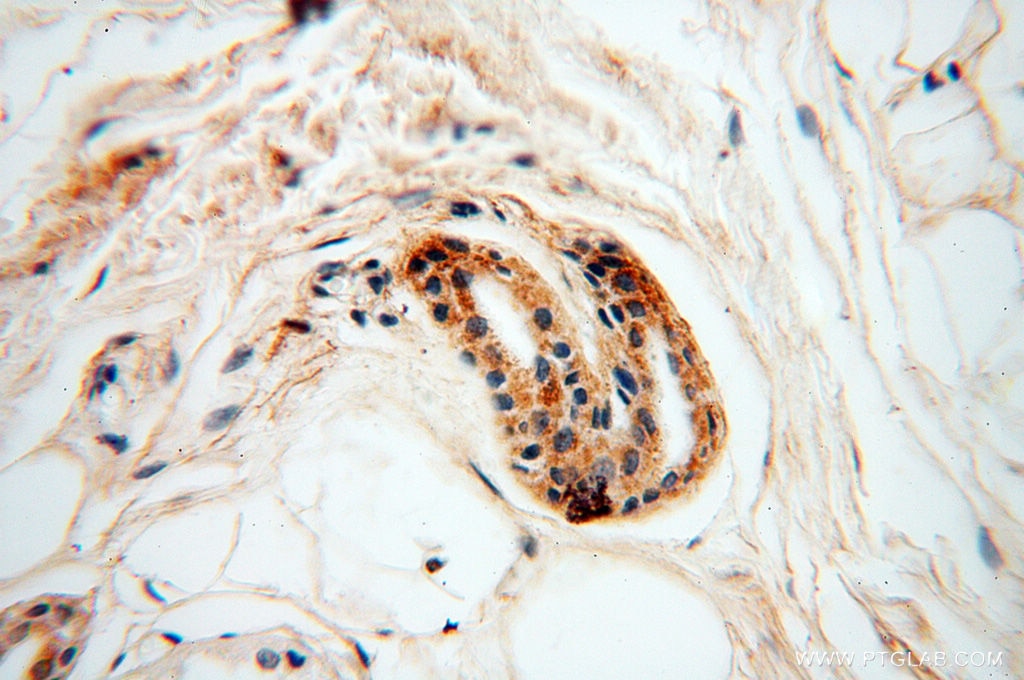 IHC staining of human skin using 10643-1-AP