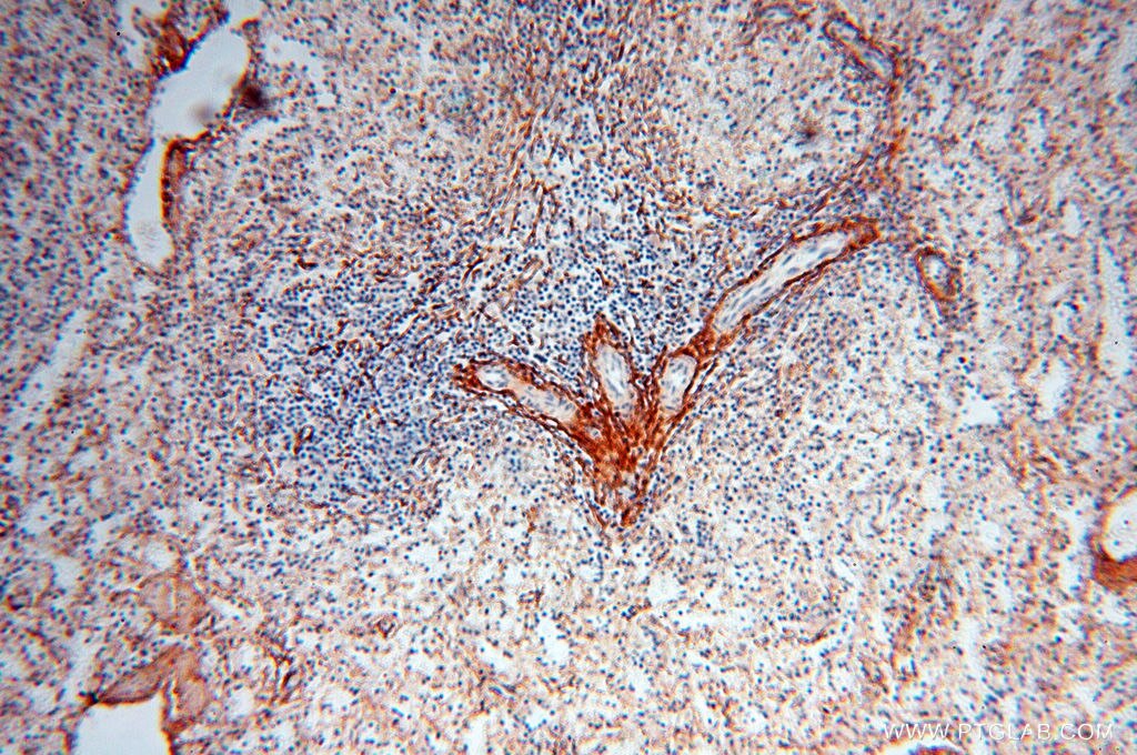 Immunohistochemistry (IHC) staining of human spleen tissue using EMILIN1 Polyclonal antibody (10643-1-AP)