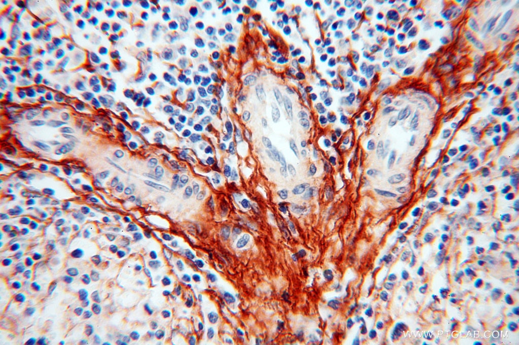 Immunohistochemistry (IHC) staining of human spleen tissue using EMILIN1 Polyclonal antibody (10643-1-AP)