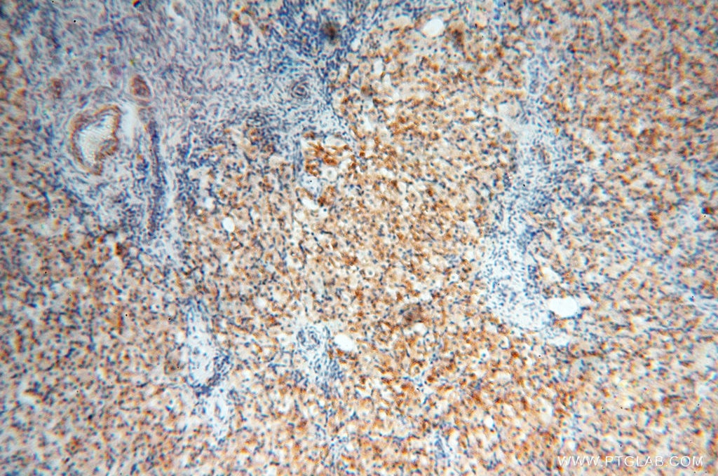 Immunohistochemistry (IHC) staining of human ovary tissue using EMILIN1 Polyclonal antibody (10643-1-AP)