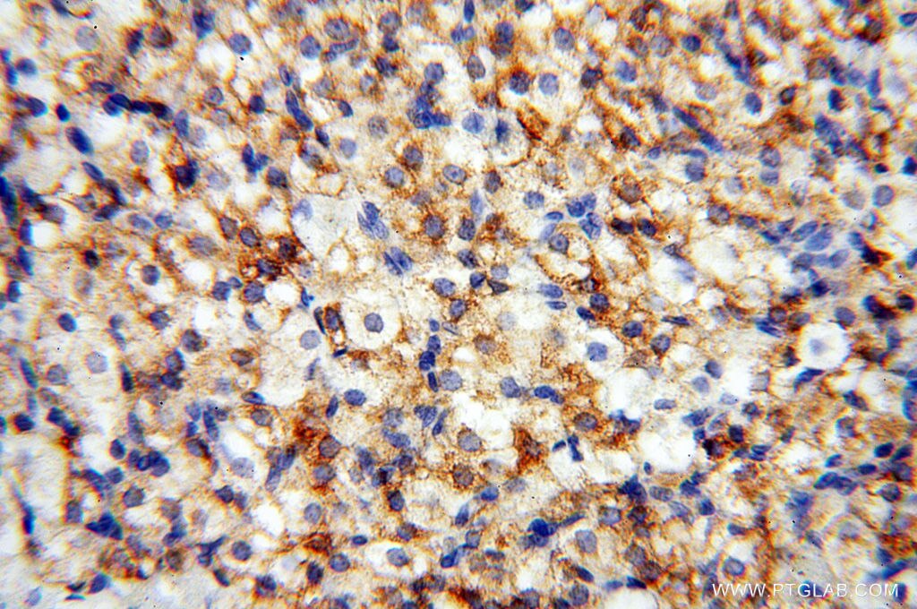 Immunohistochemistry (IHC) staining of human ovary tissue using EMILIN1 Polyclonal antibody (10643-1-AP)