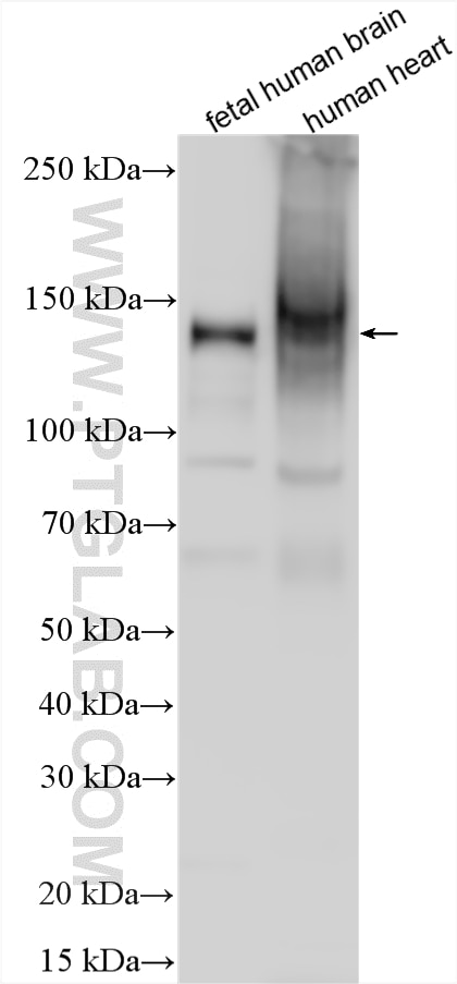 WB analysis using 10643-1-AP Western Blot (WB) analysis of various lysates using EMILIN1 Polyclonal antibody (10643-1-AP)