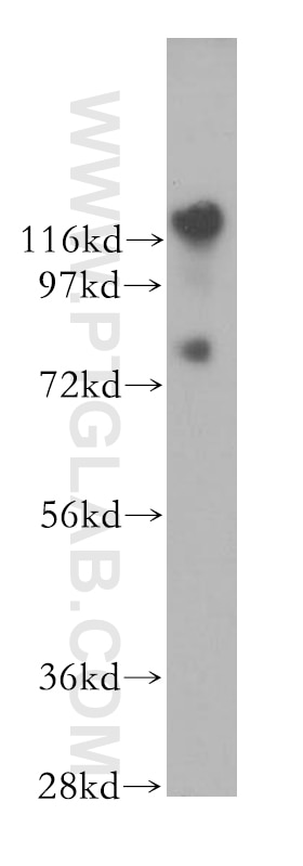 Western Blot (WB) analysis of human brain tissue using EMILIN1 Polyclonal antibody (10643-1-AP)