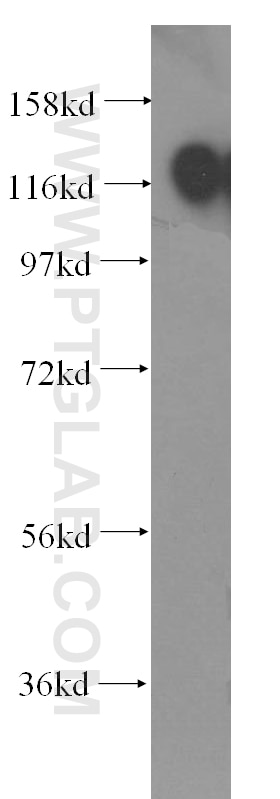 Western Blot (WB) analysis of human kidney tissue using EMILIN1 Polyclonal antibody (10643-1-AP)