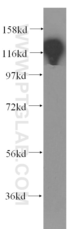 Western Blot (WB) analysis of human kidney tissue using EMILIN1 Polyclonal antibody (10643-1-AP)