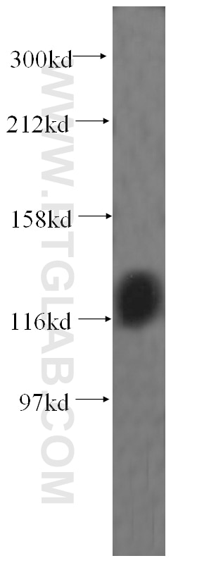 Western Blot (WB) analysis of human placenta tissue using EMILIN1 Polyclonal antibody (10643-1-AP)