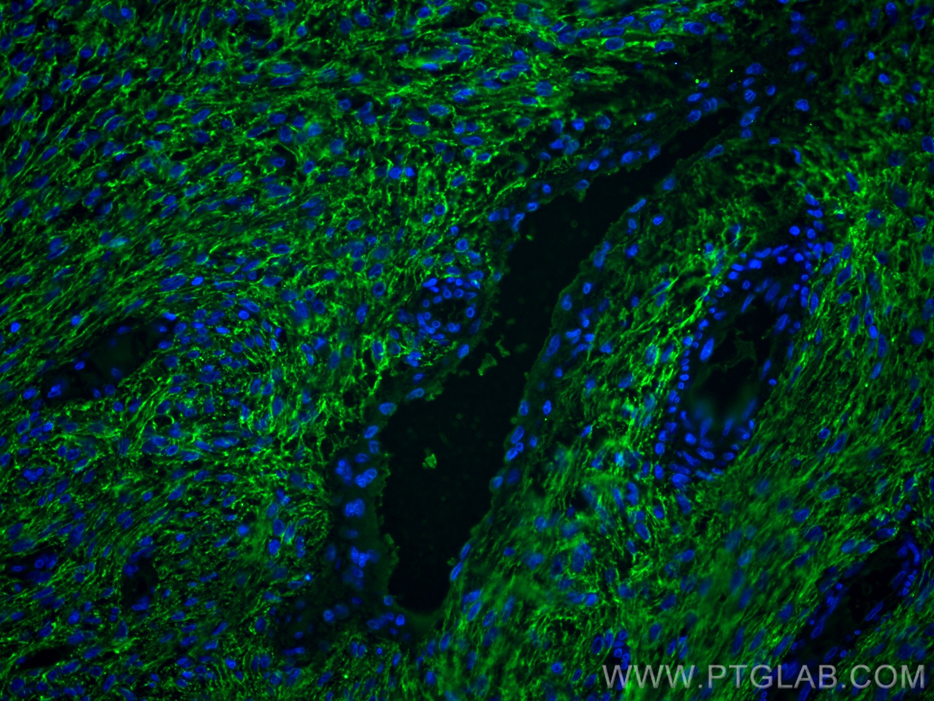 Immunofluorescence (IF) / fluorescent staining of human ovary tumor tissue using EMILIN1 Monoclonal antibody (60047-1-Ig)