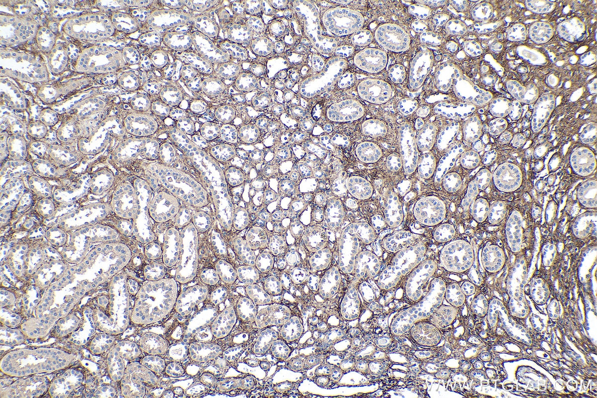 Immunohistochemistry (IHC) staining of human kidney tissue using EMILIN1 Monoclonal antibody (60047-1-Ig)