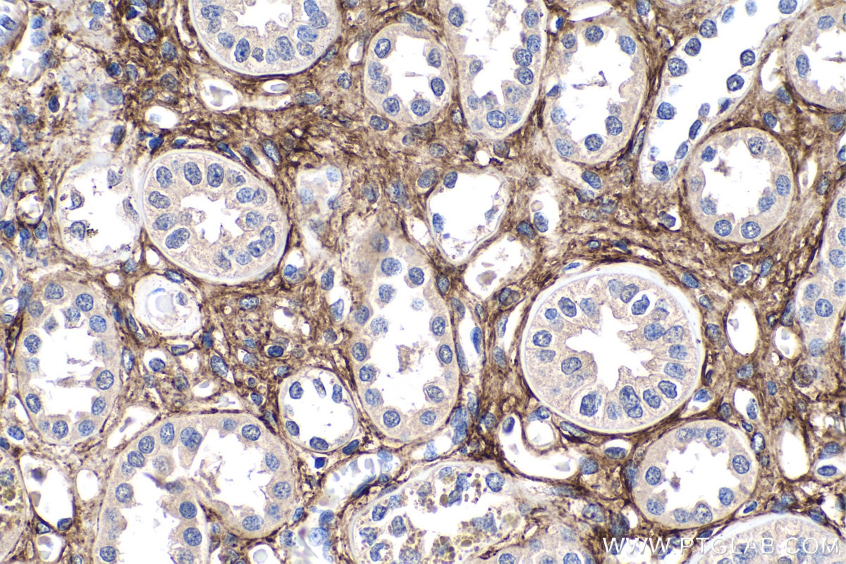 IHC staining of human kidney using 60047-1-Ig