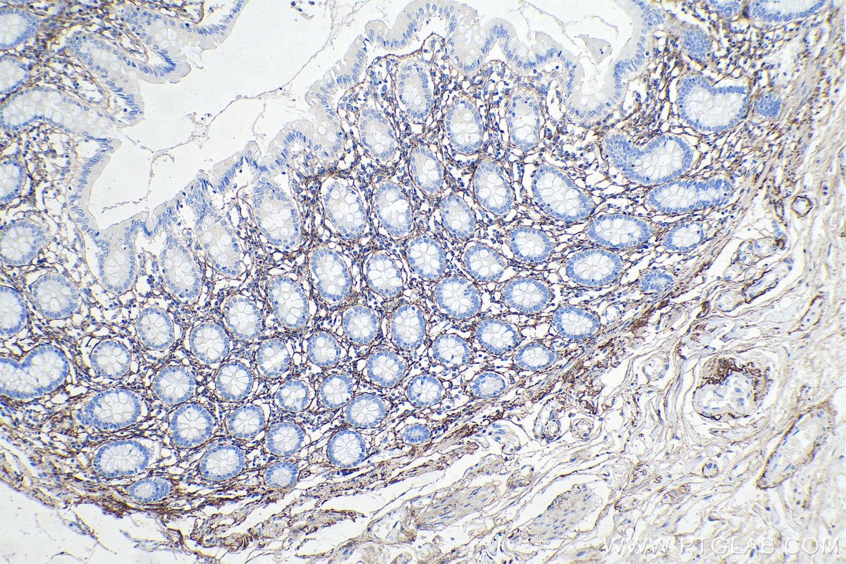 Immunohistochemistry (IHC) staining of human colon tissue using EMILIN1 Monoclonal antibody (60047-1-Ig)