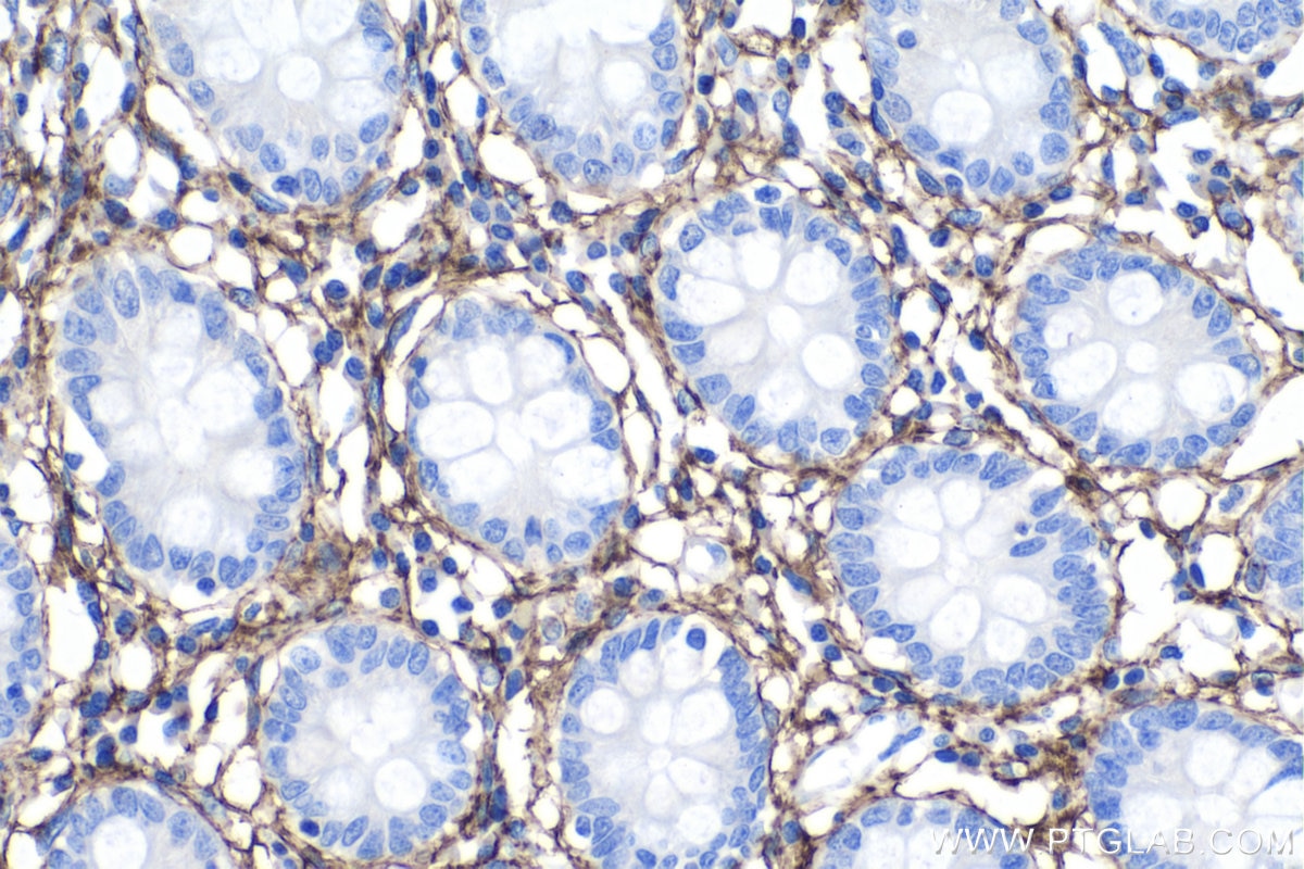 Immunohistochemistry (IHC) staining of human colon tissue using EMILIN1 Monoclonal antibody (60047-1-Ig)