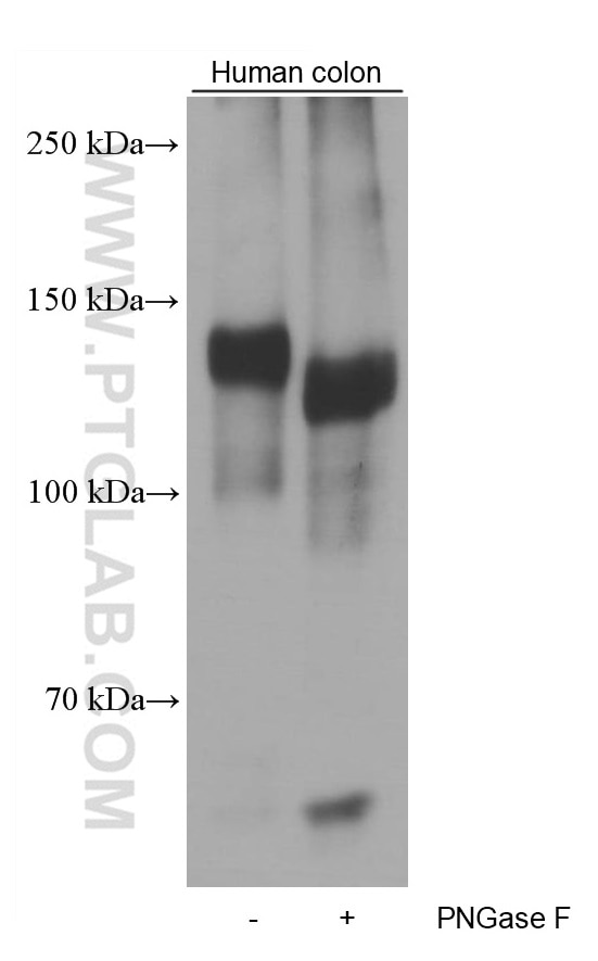 Western Blot (WB) analysis of human colon tissue using EMILIN1 Monoclonal antibody (60047-1-Ig)