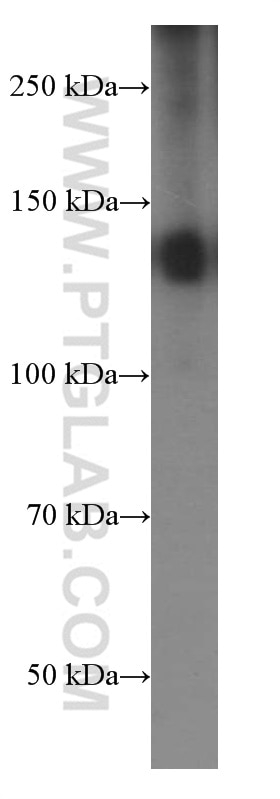 Western Blot (WB) analysis of human colon tissue using EMILIN1 Monoclonal antibody (60047-1-Ig)