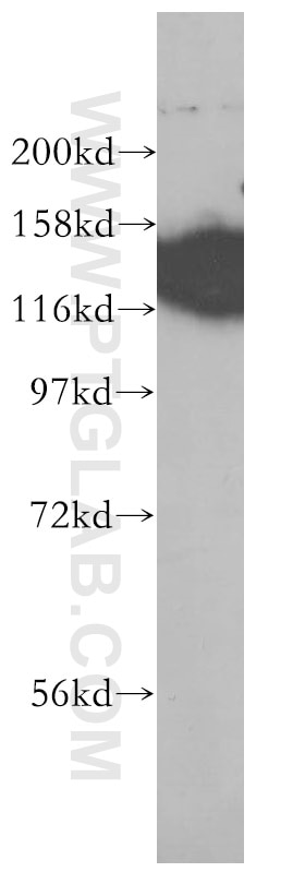 Western Blot (WB) analysis of human rectum tissue using EMILIN1 Monoclonal antibody (60047-1-Ig)