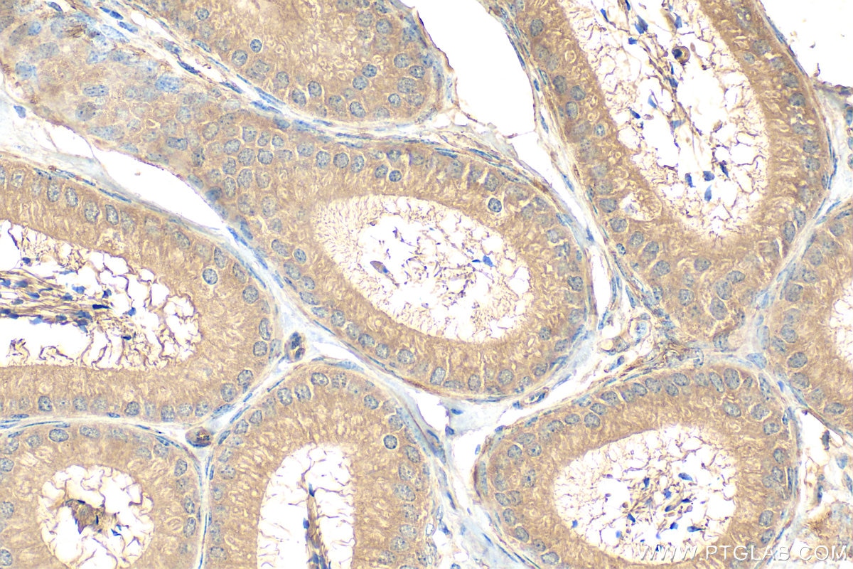 Immunohistochemical analysis of paraffin-embedded mouse testis tissue slide using 21308-1-AP (EMILIN3 antibody) at dilution of 1:200 (under 40x lens). Heat mediated antigen retrieval with Tris-EDTA buffer (pH 9.0). Immunohistochemistry (IHC) staining of mouse testis tissue using EMILIN3 Polyclonal antibody (21308-1-AP)