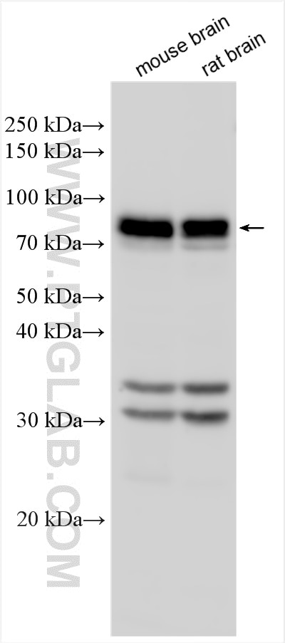 Western Blot (WB) analysis of various lysates using EML1 Polyclonal antibody (12765-1-AP)