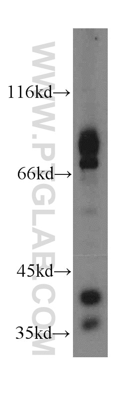 Western Blot (WB) analysis of mouse brain tissue using EML1 Polyclonal antibody (12765-1-AP)