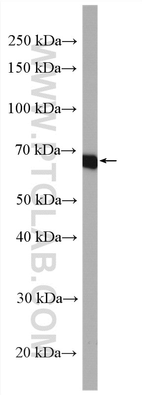 Western Blot (WB) analysis of mouse stomach tissue using EML2 Polyclonal antibody (13529-1-AP)