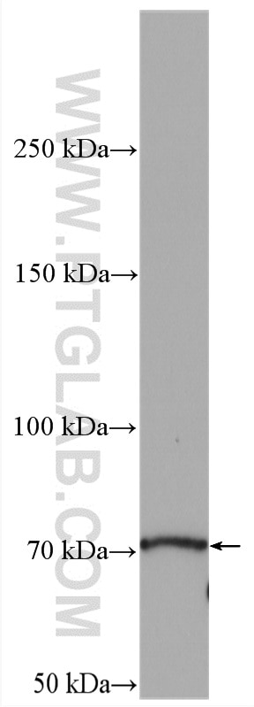 Western Blot (WB) analysis of mouse heart tissue using EML2 Polyclonal antibody (13529-1-AP)