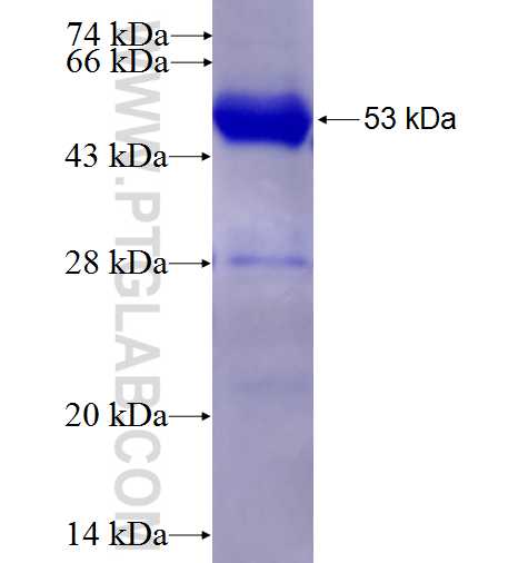 EML2 fusion protein Ag4634 SDS-PAGE