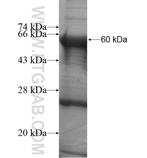 EML3 fusion protein Ag12500 SDS-PAGE EML3 fusion protein Ag12500 SDS-PAGE