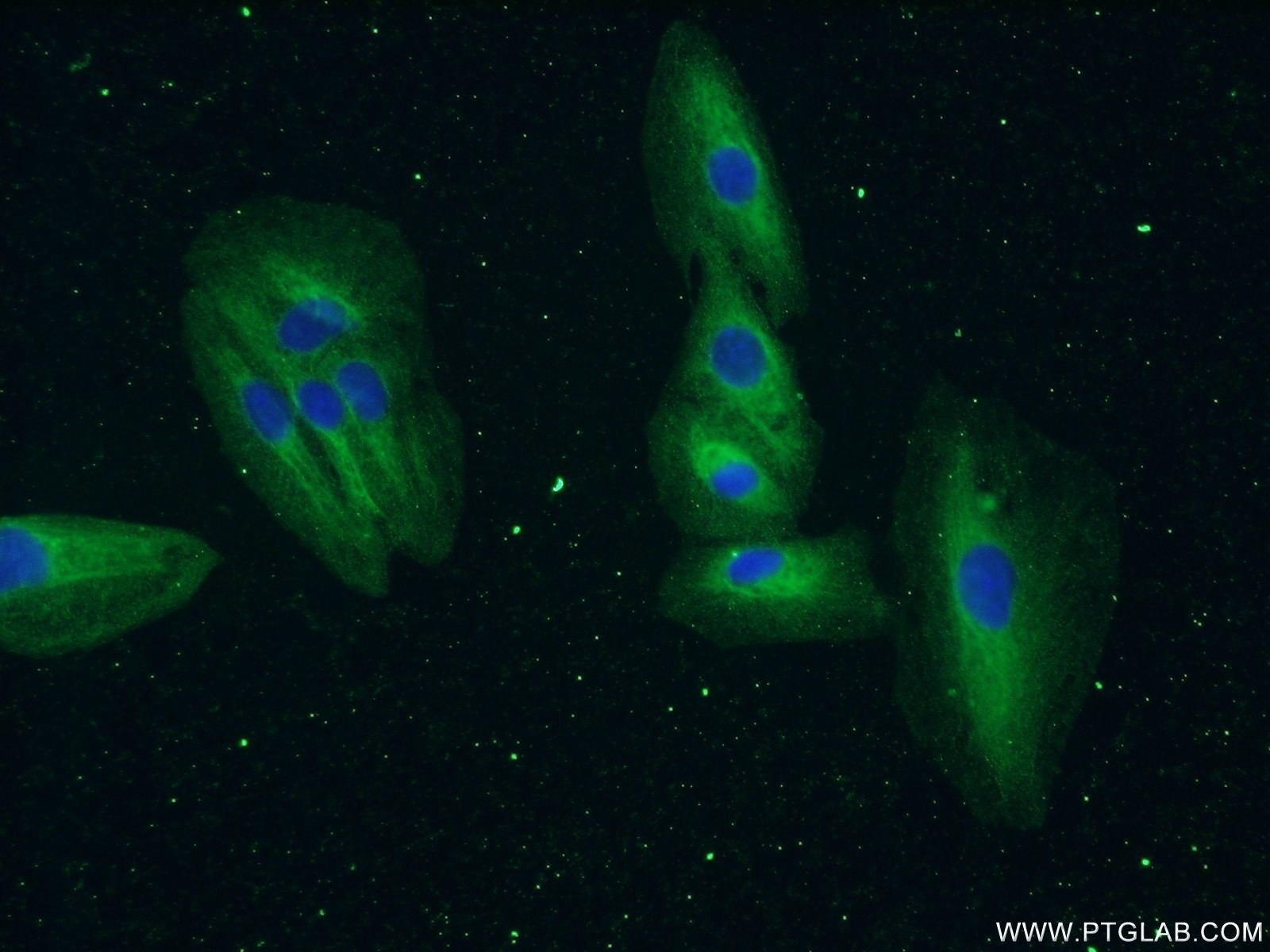 Immunofluorescence (IF) / fluorescent staining of A549 cells using EML4 Polyclonal antibody (22709-1-AP)