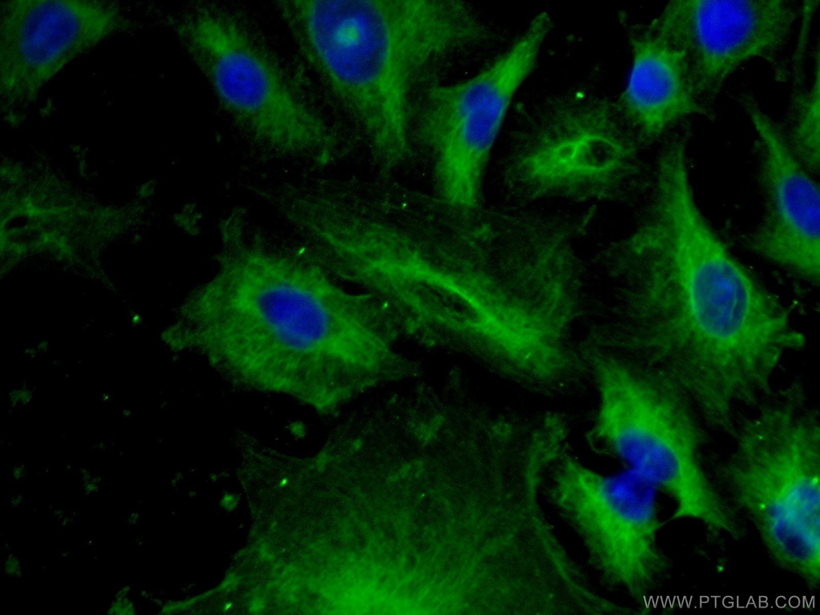 Immunofluorescence (IF) / fluorescent staining of A549 cells using EML4 Polyclonal antibody (22709-1-AP)