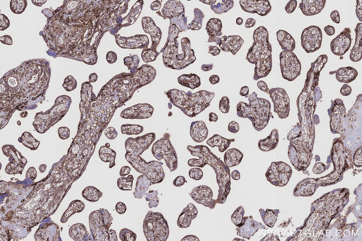 IHC staining of human placenta using 22709-1-AP Immunohistochemistry (IHC) staining of human placenta tissue using EML4 Polyclonal antibody (22709-1-AP)