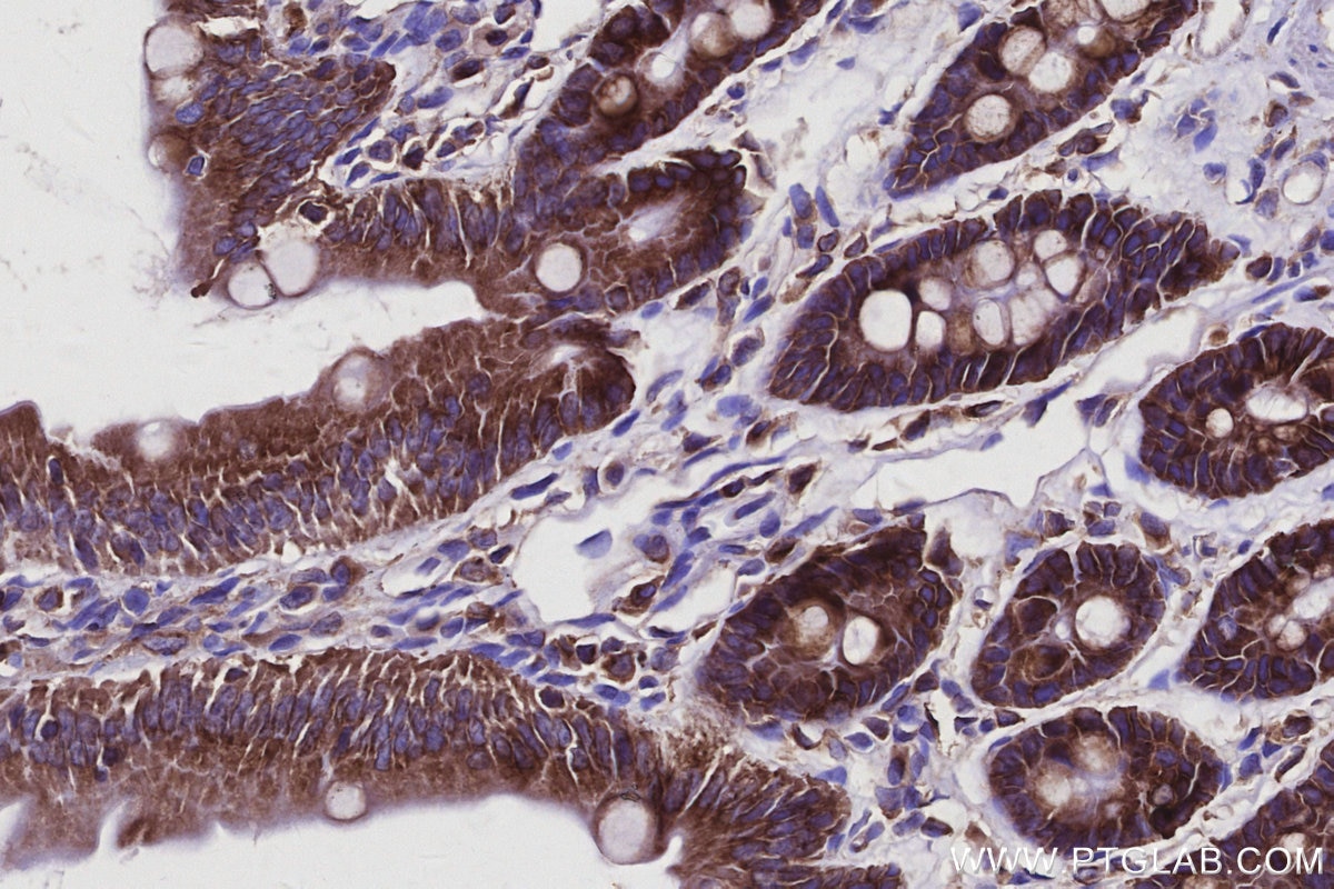 IHC staining of rat small intestine using 22709-1-AP Immunohistochemistry (IHC) staining of rat small intestine tissue using EML4 Polyclonal antibody (22709-1-AP)