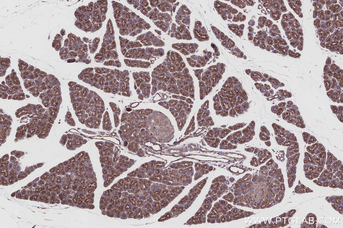 IHC staining of rat pancreas using 22709-1-AP Immunohistochemistry (IHC) staining of rat pancreas tissue using EML4 Polyclonal antibody (22709-1-AP)
