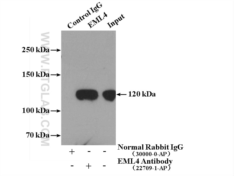 Immunoprecipitation (IP) experiment of A549 cells using EML4 Polyclonal antibody (22709-1-AP)