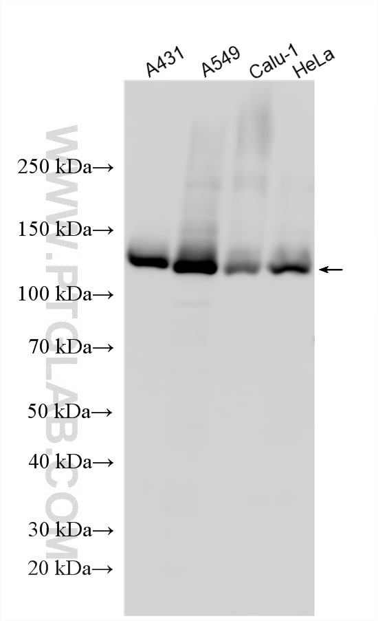 Western Blot (WB) analysis of various lysates using EML4 Polyclonal antibody (22709-1-AP)