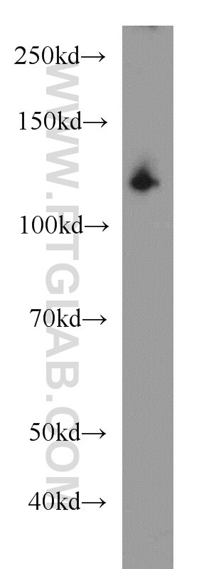 Western Blot (WB) analysis of HeLa cells using EML4 Polyclonal antibody (22709-1-AP)