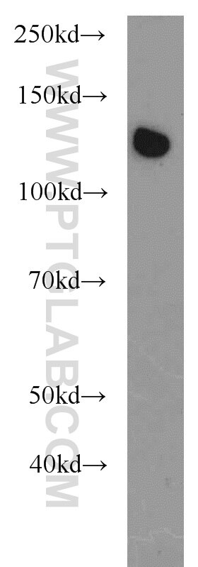 WB analysis of A431 using 22709-1-AP