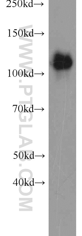 Western Blot (WB) analysis of A549 cells using EML4 Polyclonal antibody (22709-1-AP)