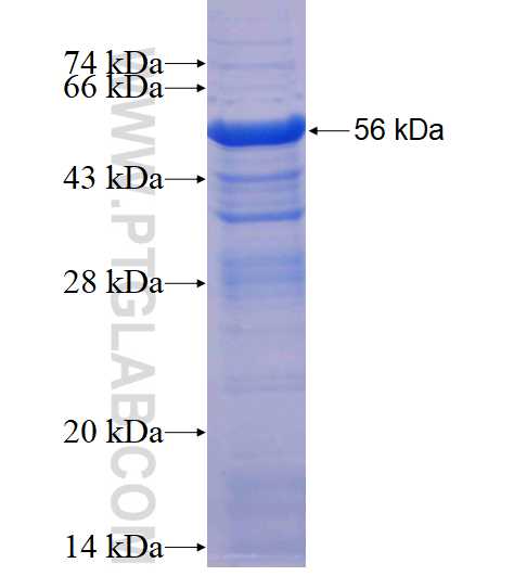 EML4 fusion protein Ag18463 SDS-PAGE