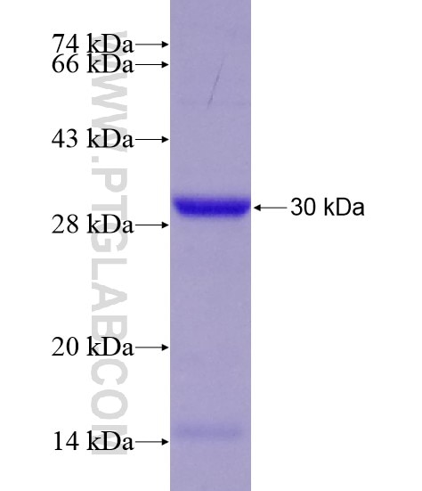 EML4 fusion protein Ag18755 SDS-PAGE