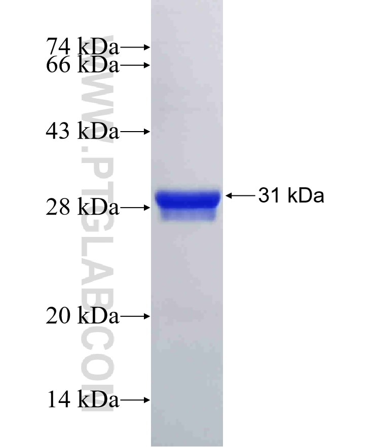 EMP1 fusion protein Ag32616 SDS-PAGE EMP1 fusion protein Ag32616 SDS-PAGE