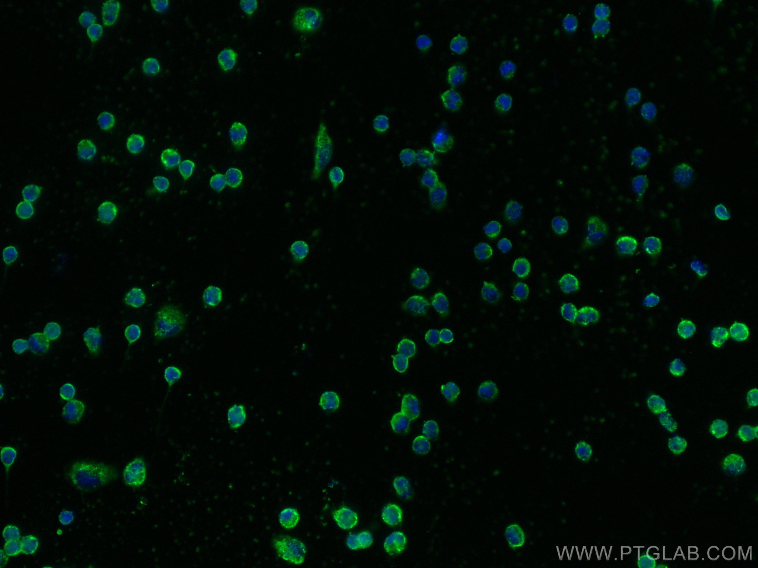 Immunofluorescence (IF) / fluorescent staining of mouse peritoneal macrophages using EMR1 Polyclonal antibody (27044-1-AP)