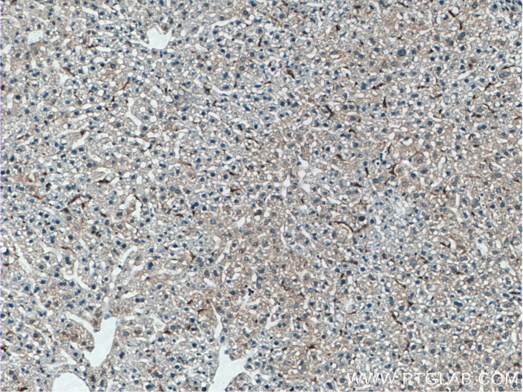 Immunohistochemistry (IHC) staining of mouse liver tissue using EMR1 Polyclonal antibody (27044-1-AP)