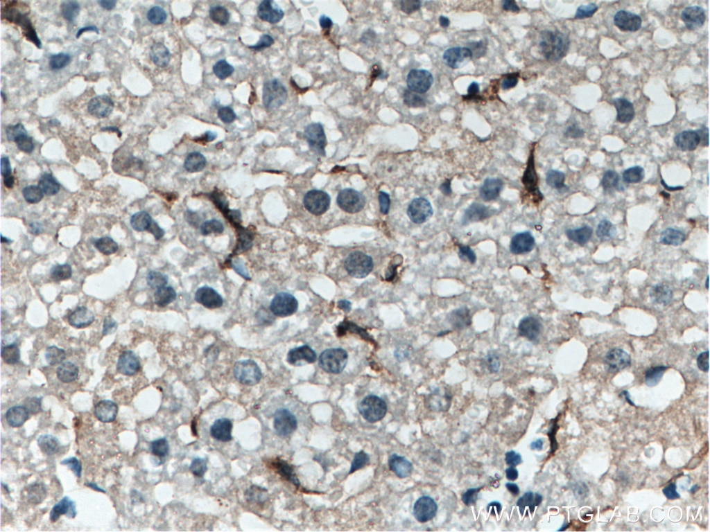 Immunohistochemistry (IHC) staining of mouse liver tissue using EMR1 Polyclonal antibody (27044-1-AP)