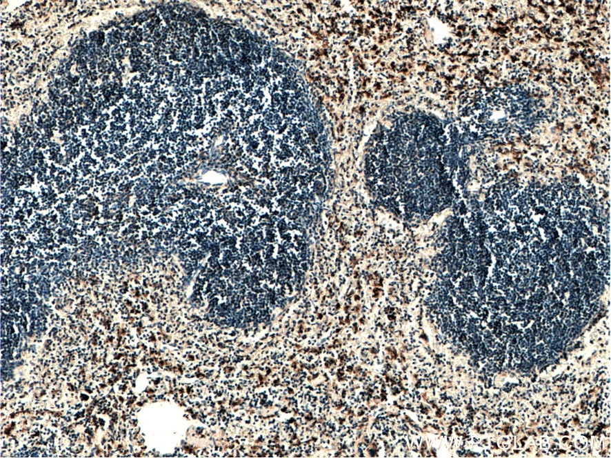 IHC staining of mouse spleen using 27044-1-AP