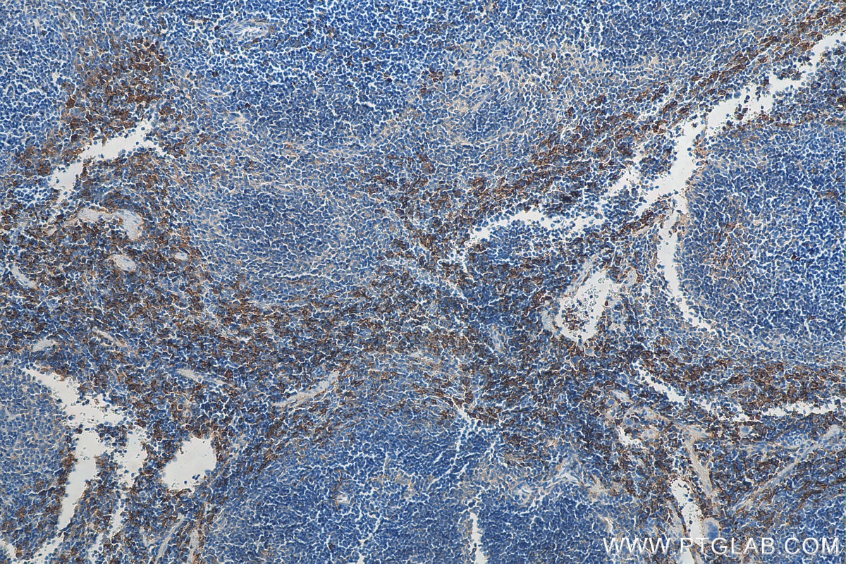 Immunohistochemistry (IHC) staining of mouse spleen tissue using EMR1 Polyclonal antibody (27044-1-AP)