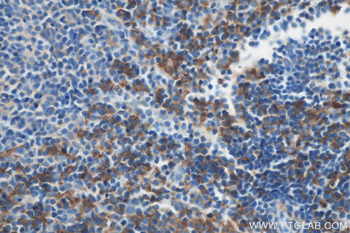 Immunohistochemistry (IHC) staining of mouse spleen tissue using EMR1 Polyclonal antibody (27044-1-AP)